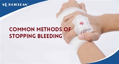 Các phương pháp phổ biến để cầm máu